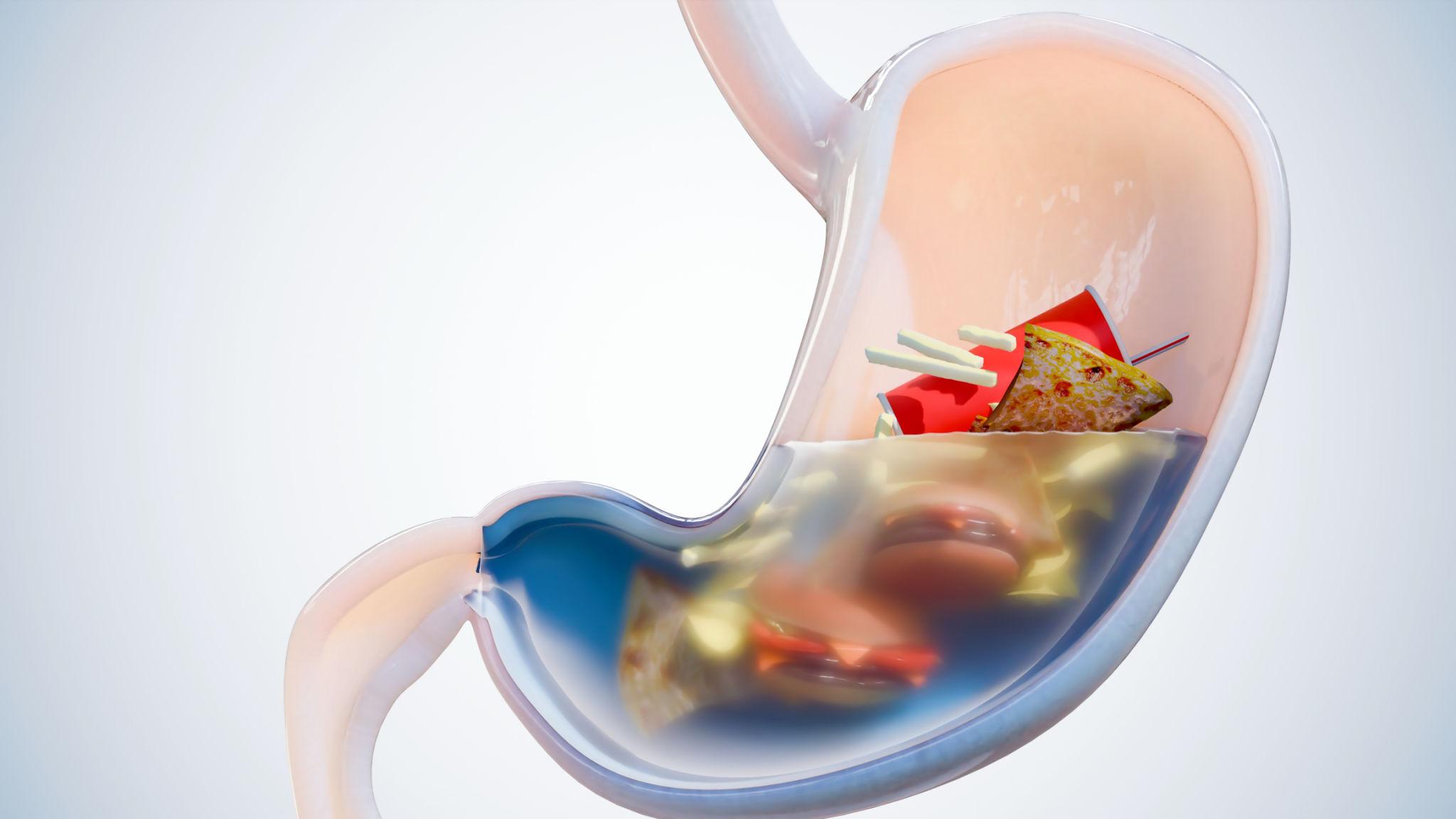 Spicy and rich dishes some people limit during symptom flares